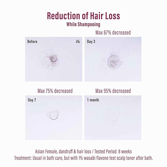 Moist Diane Extra Hair Fall Control Essence with Pump from Japan, Japanese Haircare for Damaged & Dry Hair, Natural Protein Keratin Spray for Revitalizing Scalp, 1.69 Fl Oz
