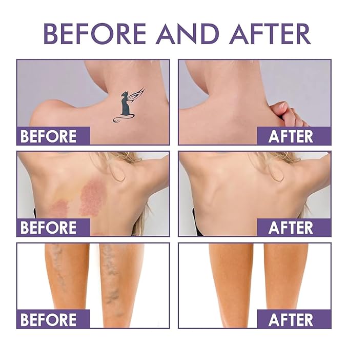 2Pcs Body Coverage Perfector - All Over Complexion Perfector, Tattoo Cover Up Makeup Long Last Waterpro of Body Foundation