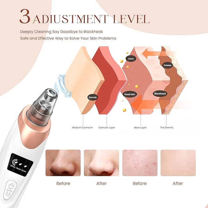 2025 Blackhead Remover Pore Vacuum,Facial Pore Cleaner-5 Suction Power,5 Probes,USB Rechargeable Blackhead Vacuum Kit Electric Acne Extractor Tool for Adult (White)