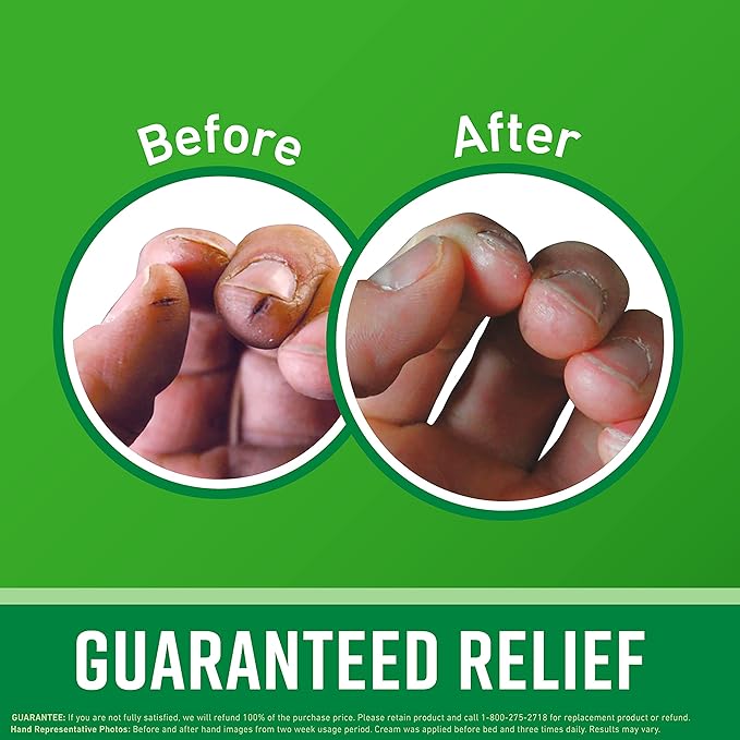 O'Keeffe's Working Hands Hand Cream for Extreme Dryness - 6.8 oz Value Size Jar (2 Pack) - Repairing Skincare for Cracked, Dry Hands