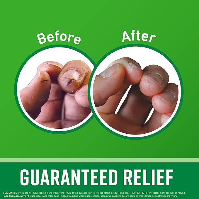 O'Keeffe's Working Hands Hand Cream for Extreme Dryness - 3.4 oz Jar (1 Pack) - Repairing Skincare for Cracked, Dry Hands