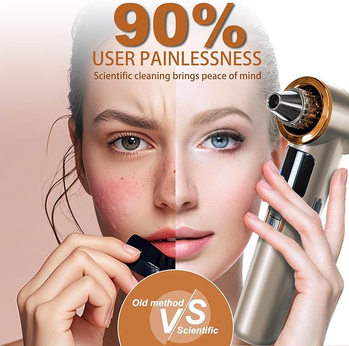 2 in 1 Blackhead Remover Pore Vacuum, Blackhead Vacuum Extractor with Heating Mode, Facial Pore Cleaner Electric, Whitehead Remover Tool-9 Suction Power, 5 Probes Blackhead Vacuum Kit for Women & Men