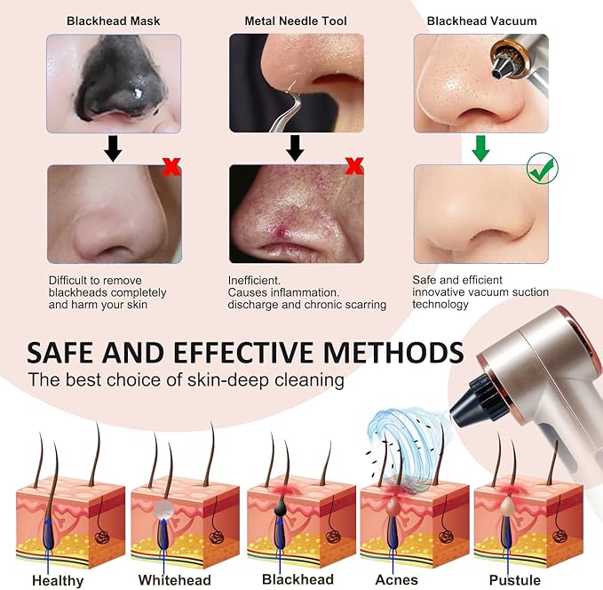 2 in 1 Blackhead Remover Pore Vacuum, Blackhead Vacuum Extractor with Heating Mode, Facial Pore Cleaner Electric, Whitehead Remover Tool-9 Suction Power, 5 Probes Blackhead Vacuum Kit for Women & Men