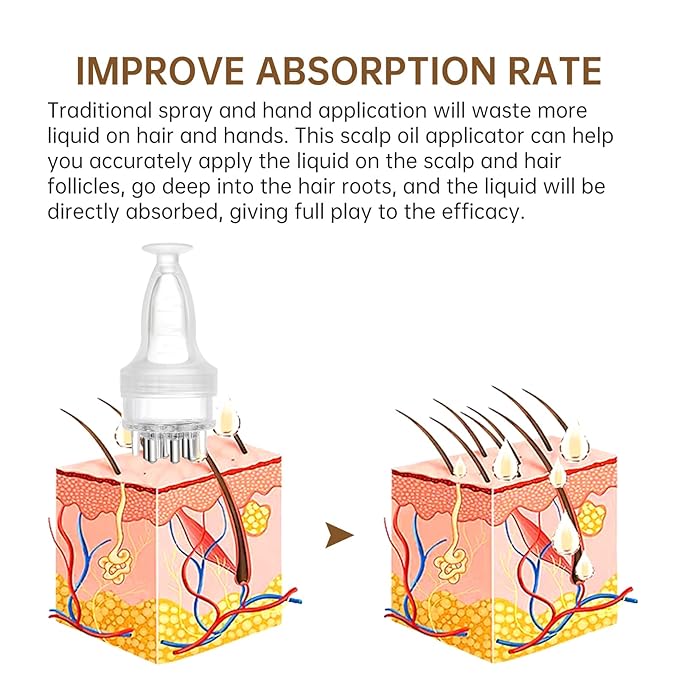 Minoxidil Applicator, Scalp Oil Applicator - Transparent easy to Observe, Easy to Clean, Controlled Flow Rate - Ideal for Minoxidiland & Wild Growth Hair Oil