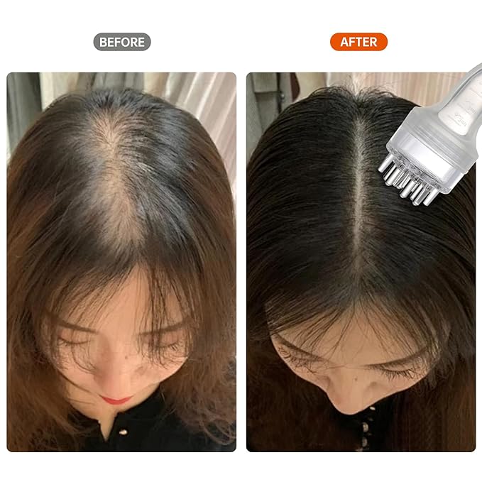 Minoxidil Applicator, Scalp Oil Applicator - Transparent easy to Observe, Easy to Clean, Controlled Flow Rate - Ideal for Minoxidiland & Wild Growth Hair Oil