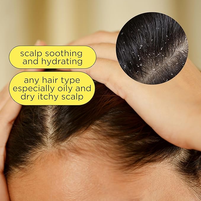 Pacifica Rosemary Mint Scalp Refresher Spray 5oz – Cooling Daily Scalp Treatment for Itchy Dry Scalp, Refreshes & Moisturizes, Vegan Leave-In Hair Mist for All Hair Types, Non-Greasy Cruelty-Free