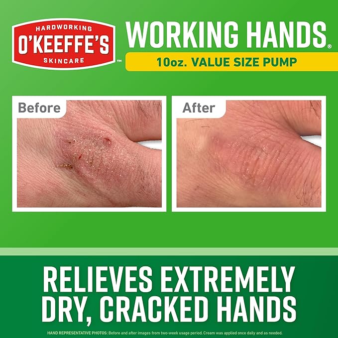O'Keeffe's Working Hands Hand Cream in a Pumpable Jar for Extreme Dryness – 10oz Pump (1 Pack) - Repairing Skincare for Cracked, Dry Hands