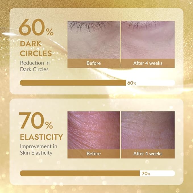 MIZON 24K Gold and Snail Mucin Hydrogel Under Eye Patches for Puffy Eyes Dark Circles Moisturizing Fine Lines Korean Skincare Pack of (Pack of 2, 120 Pairs)