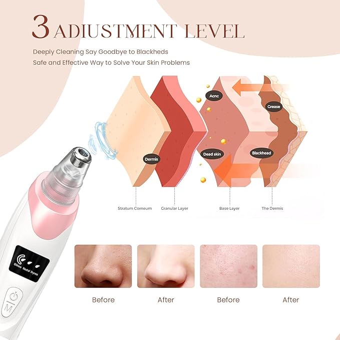 2025 Blackhead Remover Pore Vacuum,Facial Pore Cleaner-5 Suction Power,5 Probes,USB Rechargeable Blackhead Vacuum Kit Electric Acne Extractor Tool for Adult (Pink)