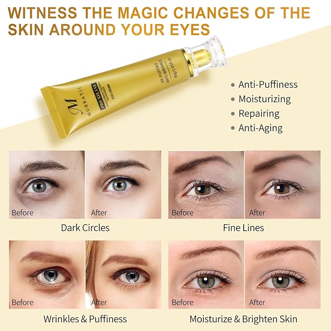6% Proxylane Eye Cream, Anti Aging Retinol Eye Cream For Dark Circles, Pro-Xylane Active Anti-Wrinkle Eye Cream,Eye Repair Cream For Puffiness For All Skin Types(30g/1.05 Fl Oz)