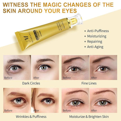 6% Proxylane Eye Cream, Anti Aging Retinol Eye Cream For Dark Circles, Pro-Xylane Active Anti-Wrinkle Eye Cream,Eye Repair Cream For Puffiness For All Skin Types(30g/1.05 Fl Oz)