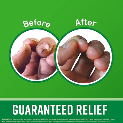 O'Keeffe's Working Hands Hand Cream for Extreme Dryness - 6.8 oz Value Size Jar (2 Pack) - Repairing Skincare for Cracked, Dry Hands