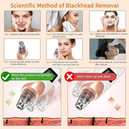 2025 Pore Vacuum,USB Rechargeable Blackhead Remover Vacuum,3 Levels Adjustable Pore Vacuum Blackhead Remover, with 5 Suction Power,6 Probes,Face Vacuum Pore Cleanser for Women & Men-White