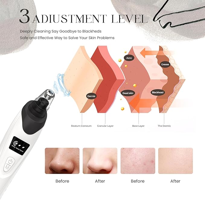 2025 Blackhead Remover Pore Vacuum,Facial Pore Cleaner-5 Suction Power,5 Probes,USB Rechargeable Blackhead Vacuum Kit Electric Acne Extractor Tool for Adult (Black)