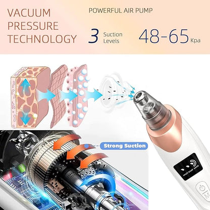 2025 Pore Vacuum,USB Rechargeable Blackhead Remover Vacuum,3 Levels Adjustable Pore Vacuum Blackhead Remover, with 5 Suction Power,6 Probes,Face Vacuum Pore Cleanser for Women & Men-White