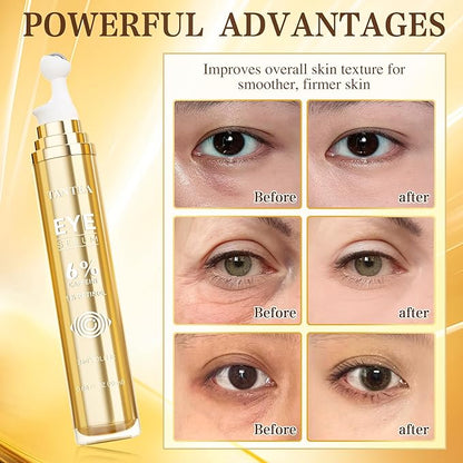 6% Caffeine Eye Cream for Puffy Eyes & Dark Circles, 1% Retinol Eye Serum for Under Eye Bags, Anti-Aging Eye Treatment for Men and Women