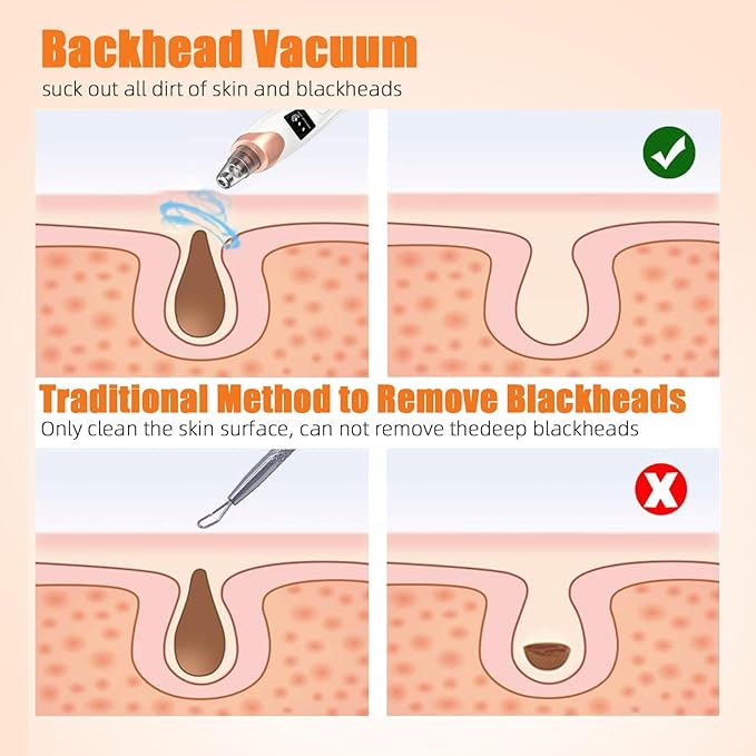 2025 Pore Vacuum,USB Rechargeable Blackhead Remover Vacuum,3 Levels Adjustable Pore Vacuum Blackhead Remover, with 5 Suction Power,6 Probes,Face Vacuum Pore Cleanser for Women & Men-White