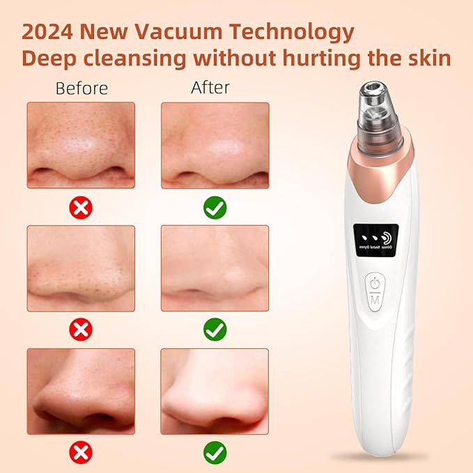 2025 Pore Vacuum,USB Rechargeable Blackhead Remover Vacuum,3 Levels Adjustable Pore Vacuum Blackhead Remover, with 5 Suction Power,6 Probes,Face Vacuum Pore Cleanser for Women & Men-White