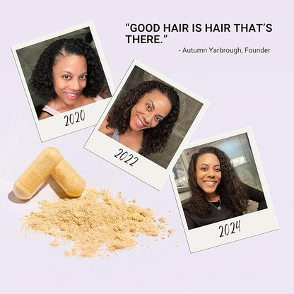 NU Standard TAKE N GO Hair Vitamins for Faster Hair Growth and Loss for Women | Collagen and Biotin Supplement | Scalp Care Treatment | Combat Hair Thinning | DHT Blockers, BioPerine | 30-Day Supply
