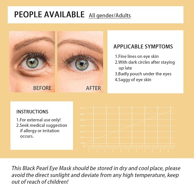 24k Gold Under Eye Patches, Eye Mask for Puffy Eyes Dark Circles Bags and Wrinkles, Moisturizing Fine Lines Under Eye Patches for Women (30 Pairs)