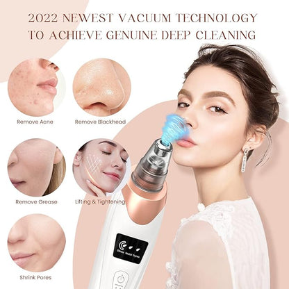 2025 Blackhead Remover Pore Vacuum,Facial Pore Cleaner-5 Suction Power,5 Probes,USB Rechargeable Blackhead Vacuum Kit Electric Acne Extractor Tool for Adult (White)