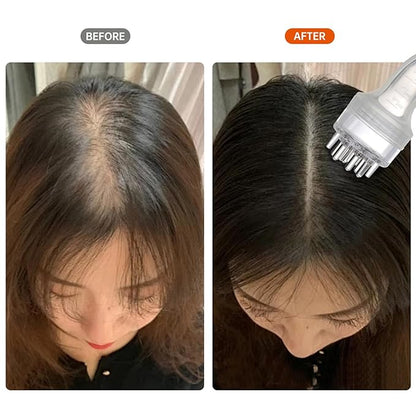 Minoxidil Applicator, Scalp Oil Applicator - Transparent easy to Observe, Easy to Clean, Controlled Flow Rate - Ideal for Minoxidiland & Wild Growth Hair Oil