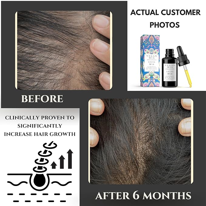 USDA Organic Rosemary Oil for Hair Growth with Castor, Jojoba & More by Vegan Mia | for Intense Nourishment & Dry Scalp Treatment - Get Healthier, Thicker & Shiny Hair Naturally (with Exclusive eBook)