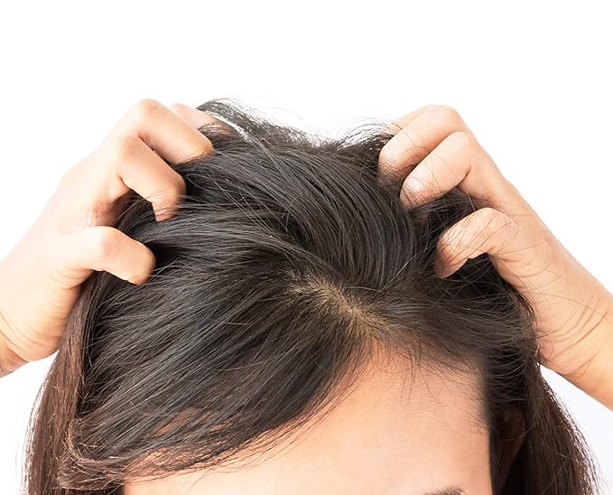 Difeel Elite Scalp Care with Peppermint & Tea Tree Oil Hair Scalp Treatment for Dry, Flaky Scalp 3 oz. - Tea Tree Hair and Scalp Treatment with Peppermint