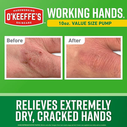 O'Keeffe's Working Hands Hand Cream in a Pumpable Jar for Extreme Dryness – 10oz Pump (1 Pack) - Repairing Skincare for Cracked, Dry Hands